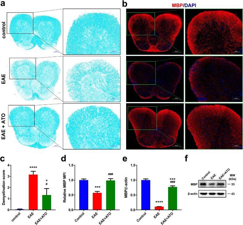 ATO reduces demyelination in EAE mice spinal cords: LFB staining, demyelination scores, MBP immunofluorescence, and MBP mRNA and protein levels.